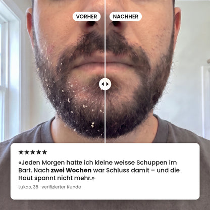 Reinigendes Peeling für Kopfhaut und Bart – 02_de