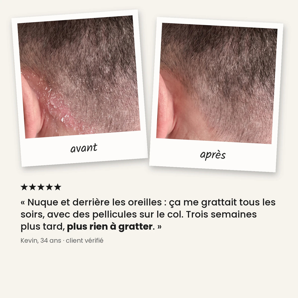 Gommage purifiant cuir chevelu et barbe – 06