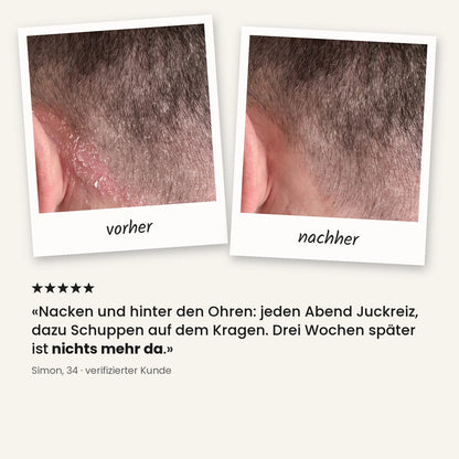 Reinigendes Peeling für Kopfhaut und Bart – 06_de