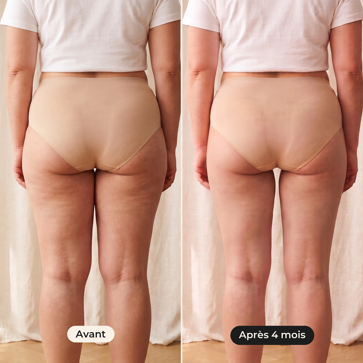 Legging de compression lipœdème