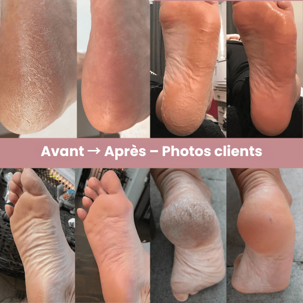 Silkfeet Pro avec 60 Pads de rechange (offerts)