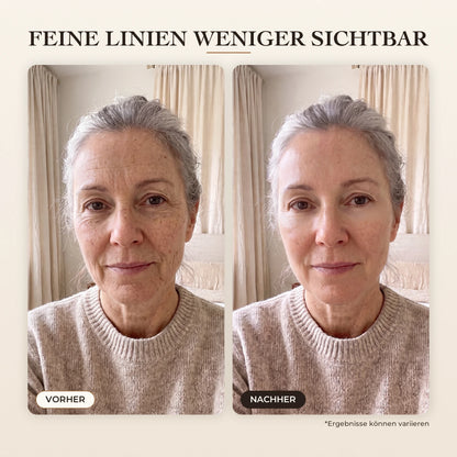 Sérum Coréen Effet Liftant – 04-DE