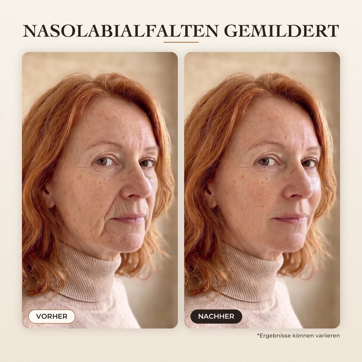 Sérum Coréen Effet Liftant – 06-DE