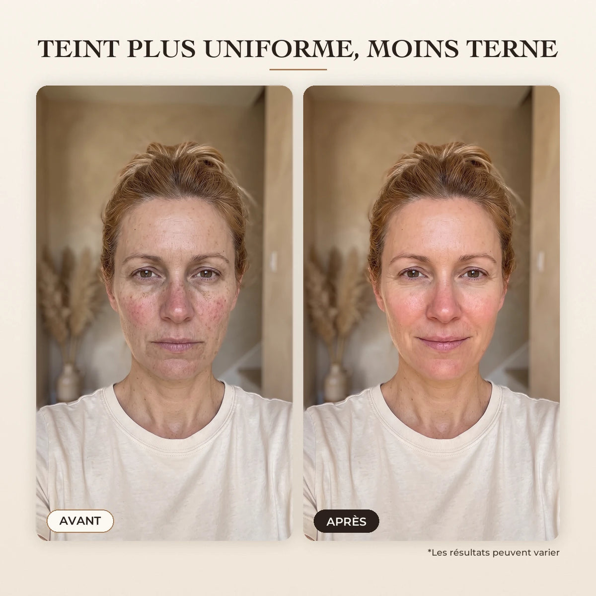 Sérum Coréen Effet Liftant – 12-FR