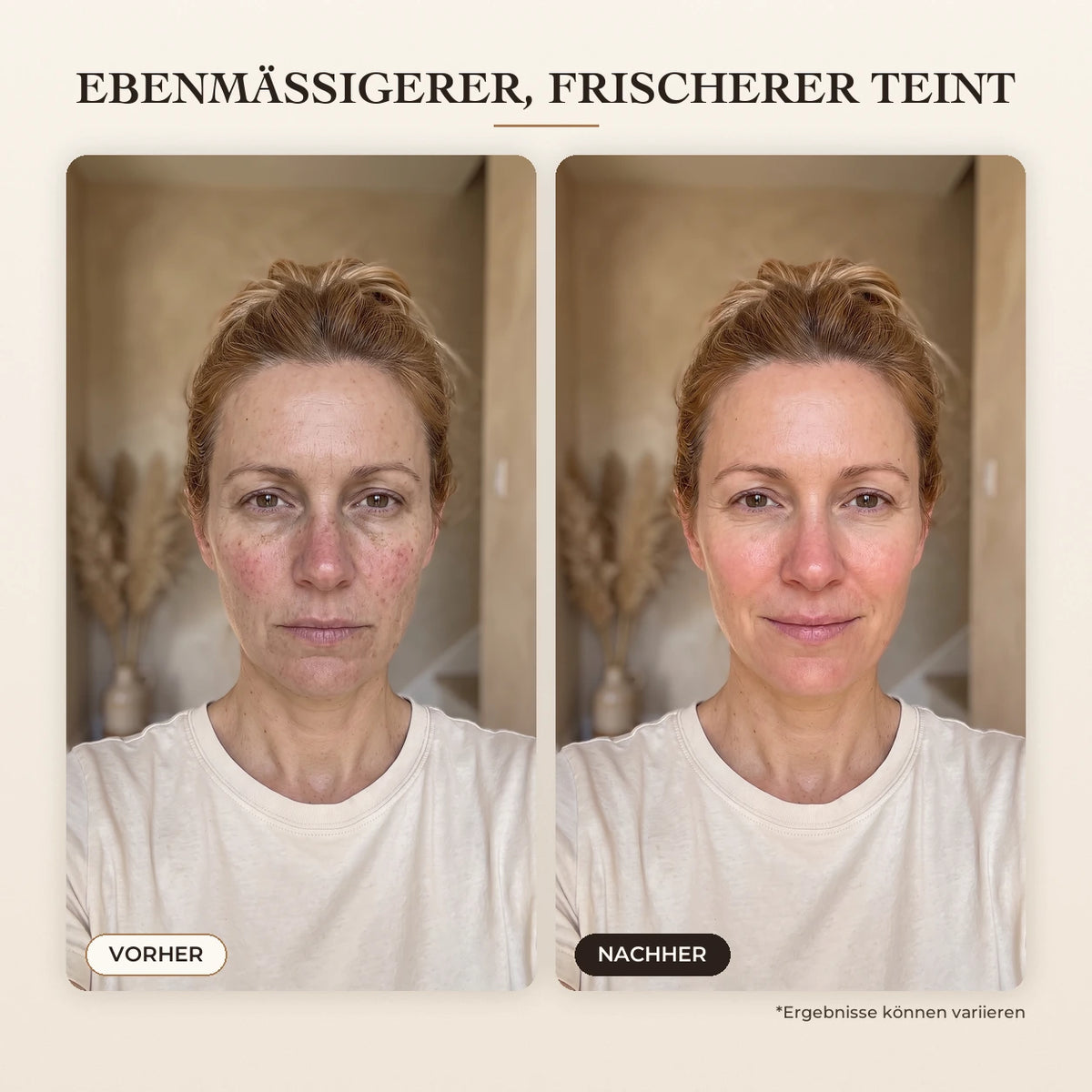 Sérum Coréen Effet Liftant – 12-DE