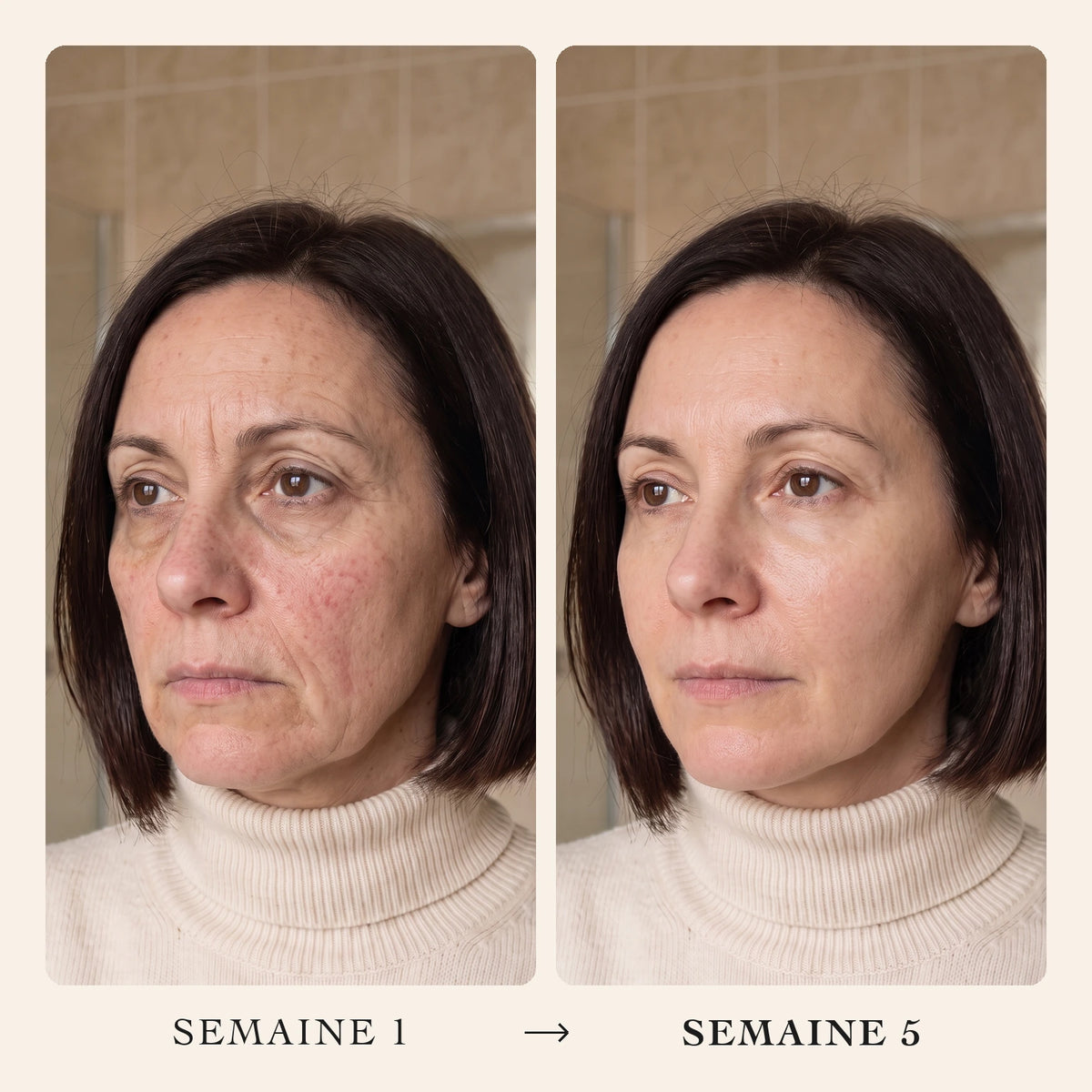 Sérum coréen au collagène Pratikae – 04-FR