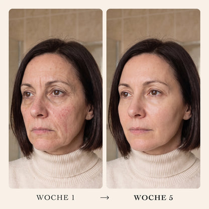 Sérum coréen au collagène Pratikae – 04-DE