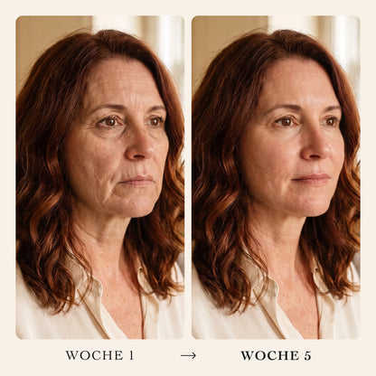Sérum coréen au collagène Pratikae – 08-DE
