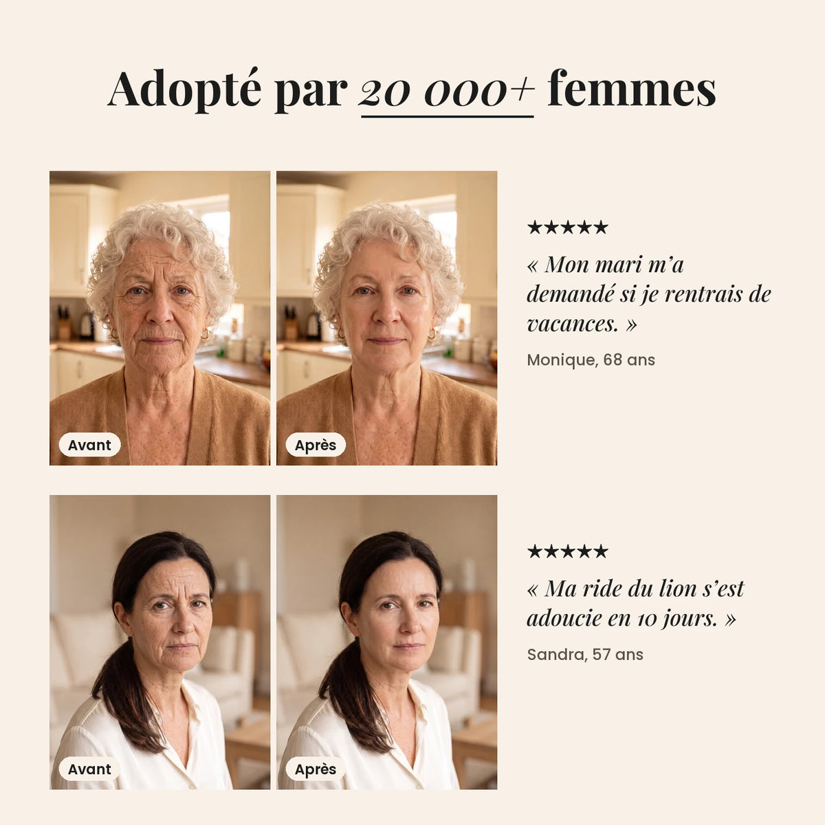 Lisseur de rides 05-FR