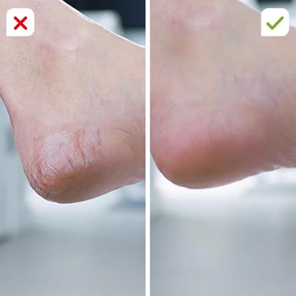 Silkfeet Pro avec 60 Pads de rechange (offerts)