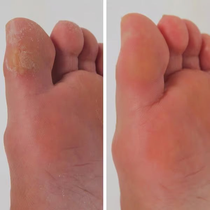 Silkfeet Pro avec 60 Pads de rechange (offerts)