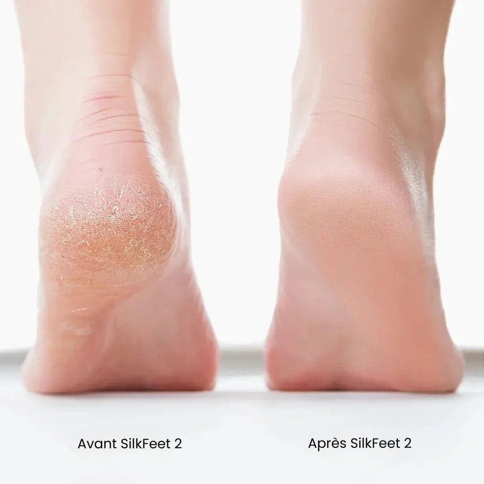 SilkFeet 2 - Des pieds doux sans visites coûteuses en salon