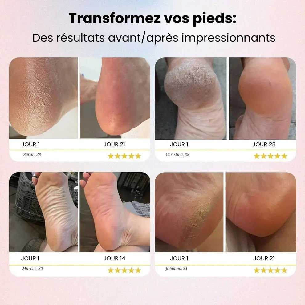 SilkFeet 2 - Des pieds doux sans visites coûteuses en salon
