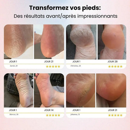 SilkFeet 2 - Des pieds doux sans visites coûteuses en salon